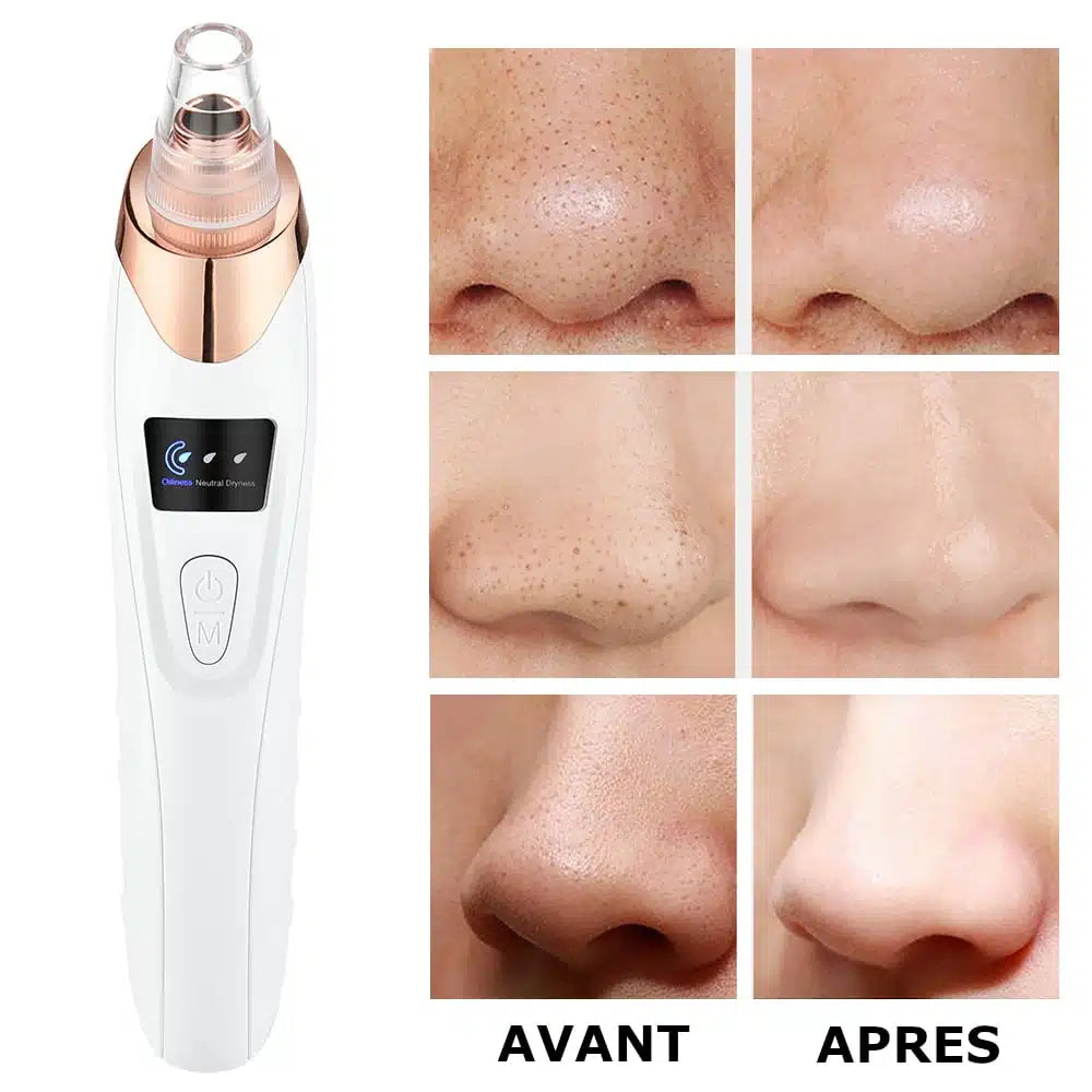 MACHINE ASPIRANTE ANTI-SÉBUM